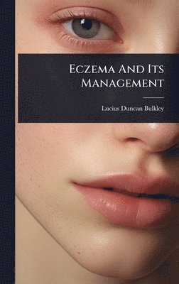 Lucius Duncan Bulkley - Eczema And Its Management, Inbunden. Tillgänglighet: Lägg i varukorg