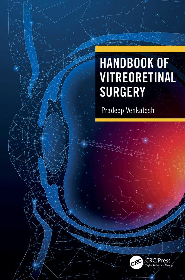Pradeep Venkatesh - Handbook of Vitreoretinal Surgery, Inbunden. Tillgänglighet: Lägg i varukorg