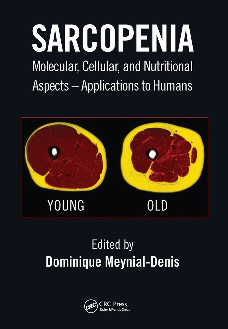 Dominique Meynial-Denis - Sarcopenia, Häftad