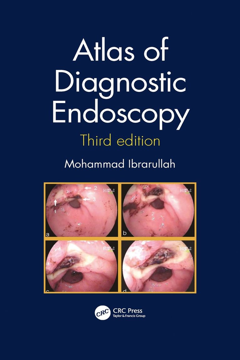 Mohammad Ibrarullah - Atlas of Diagnostic Endoscopy, 3E, Häftad