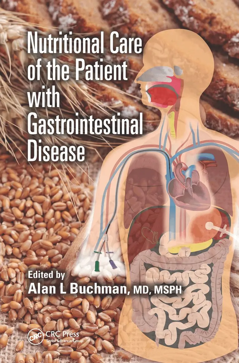 Alan L Buchman - Nutritional Care of the Patient with Gastrointestinal Disease, Häftad. Tillgänglighet: Lägg i varukorg