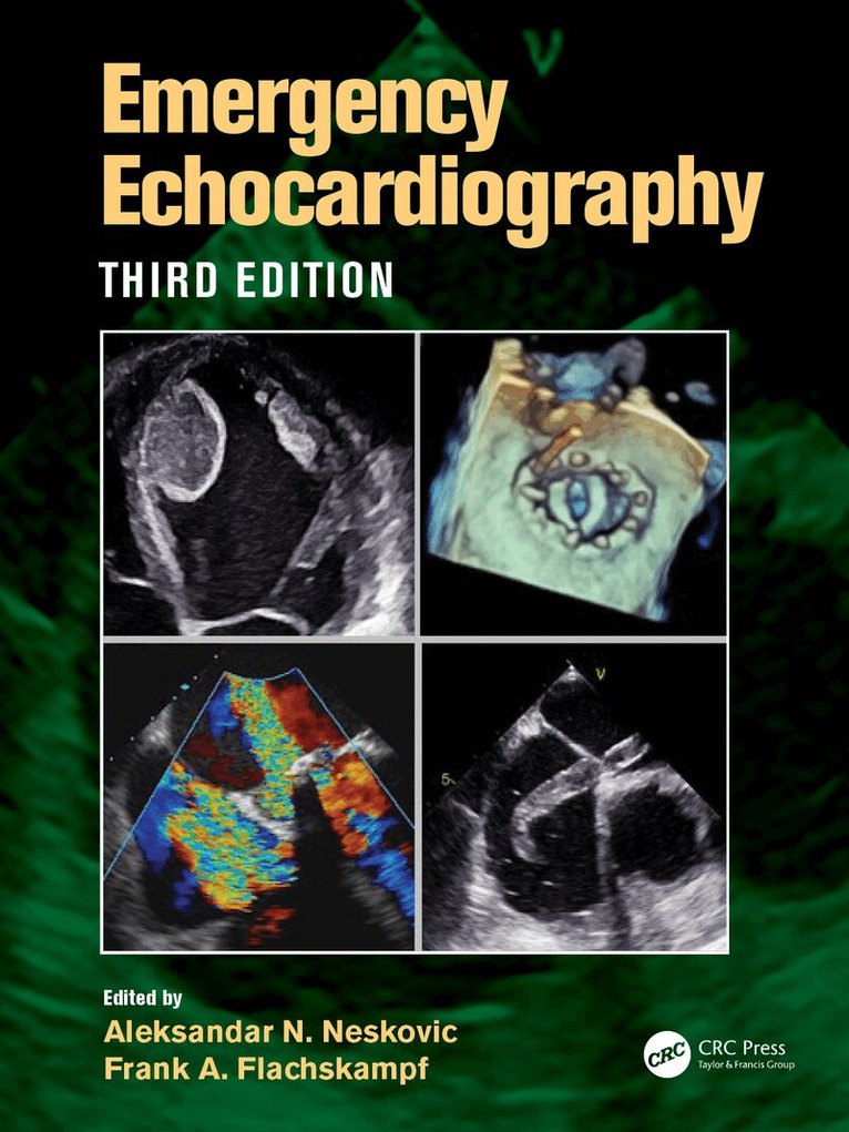 Aleksandar N. Neskovic, Frank A. Flachskampf - Emergency Echocardiography, Häftad. Tillgänglighet: Lägg i varukorg