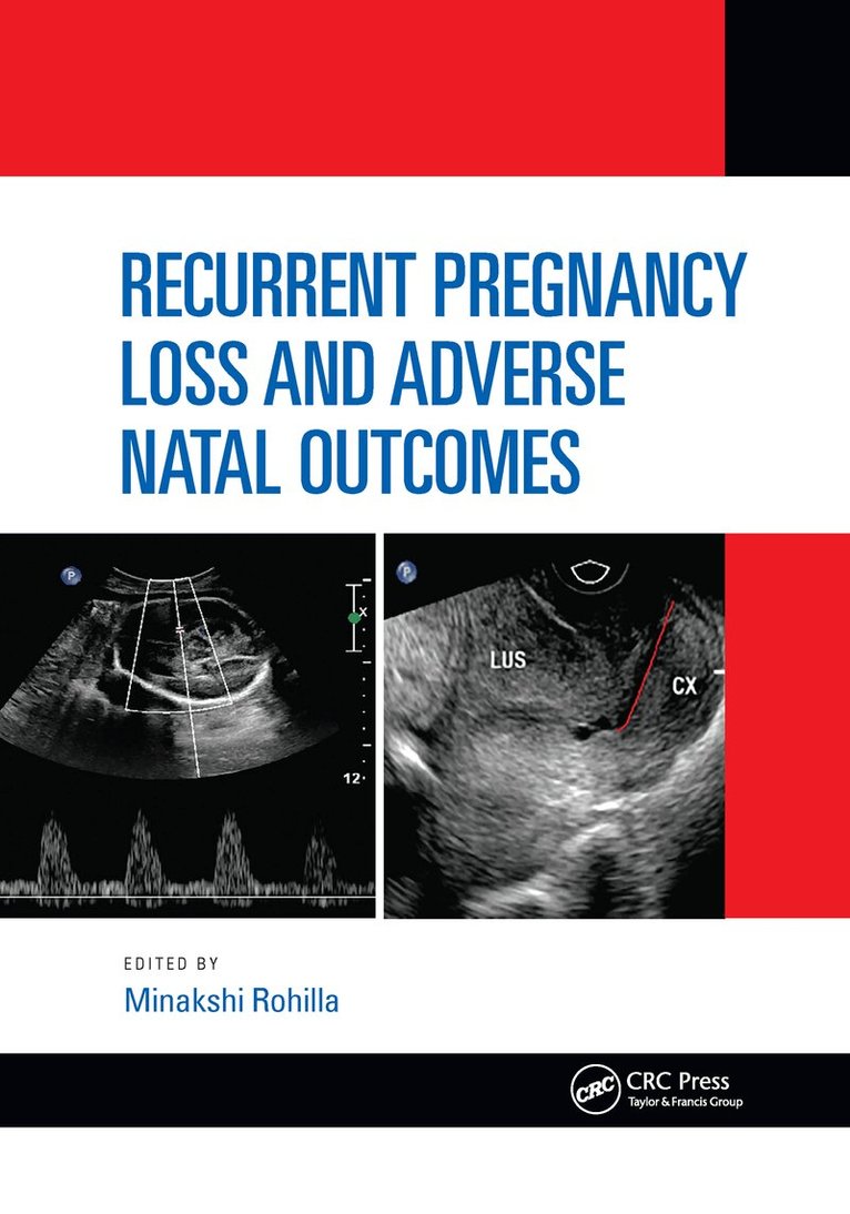 Minakshi Rohilla - Recurrent Pregnancy Loss and Adverse Natal Outcomes, Häftad