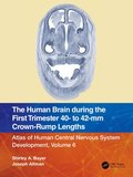The Human Brain during the First Trimester 40- to 42-mm Crown-Rump Lengths