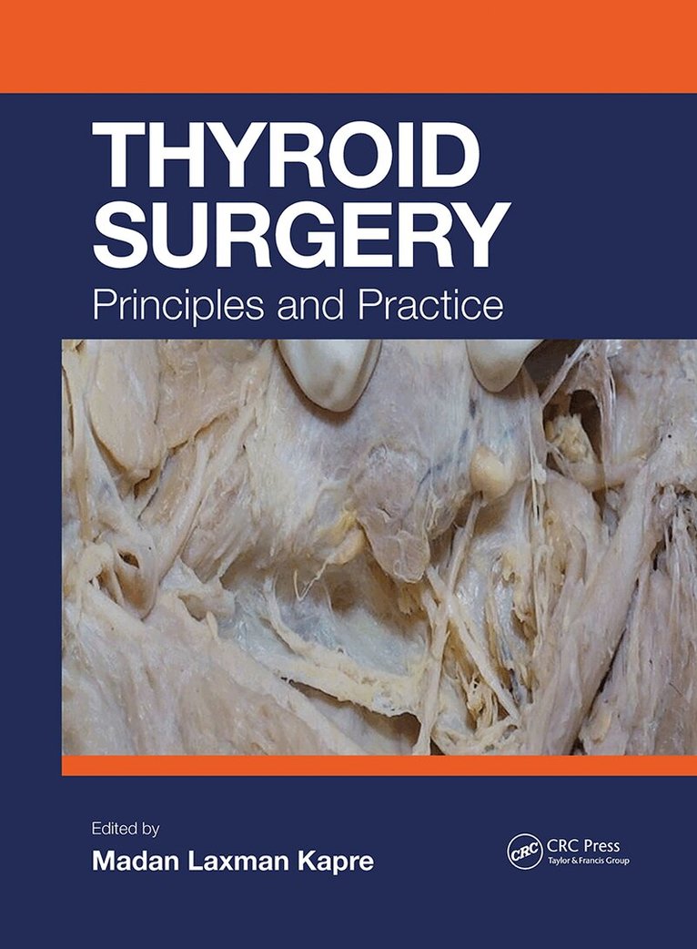 Madan Kapre - Thyroid Surgery, Häftad