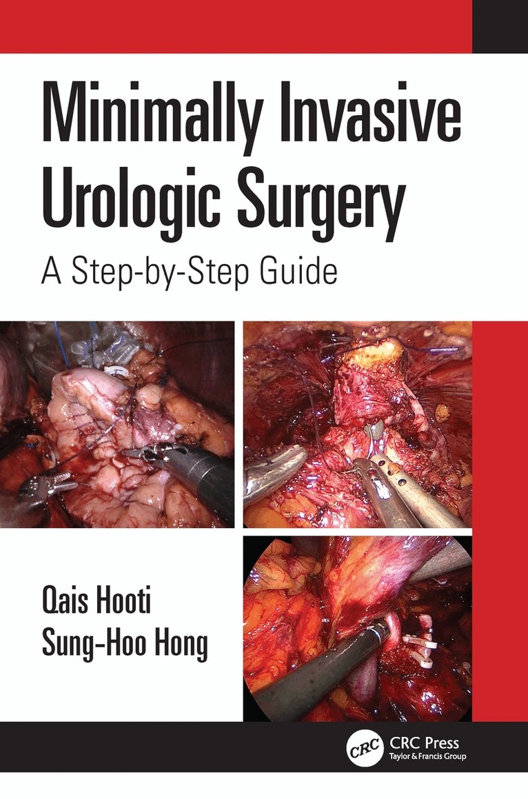 Qais Hooti, Sung-Hoo Hong - Minimally Invasive Urologic Surgery, Häftad. Tillgänglighet: Lägg i varukorg