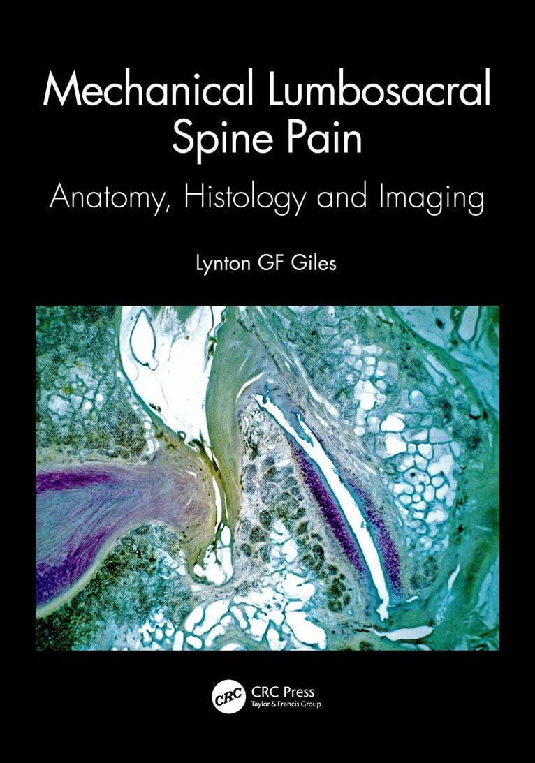 Lynton GF Giles - Mechanical Lumbosacral Spine Pain, Häftad. Tillgänglighet: Lägg i varukorg