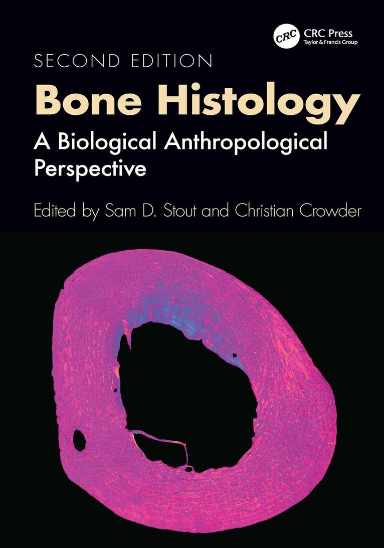 Sam D. Stout, Christian Crowder - Bone Histology, Inbunden. Tillgänglighet: Lägg i varukorg