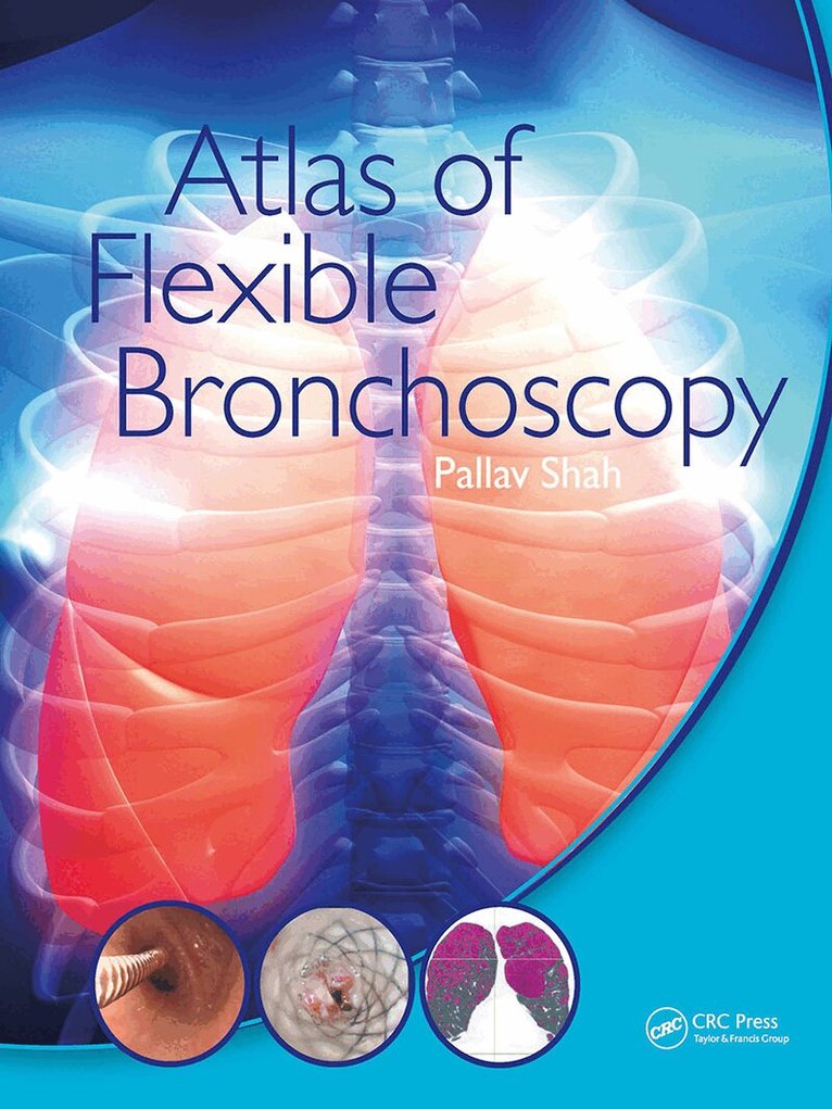 Pallav Shah - Atlas of Flexible Bronchoscopy, Häftad. Tillgänglighet: Lägg i varukorg