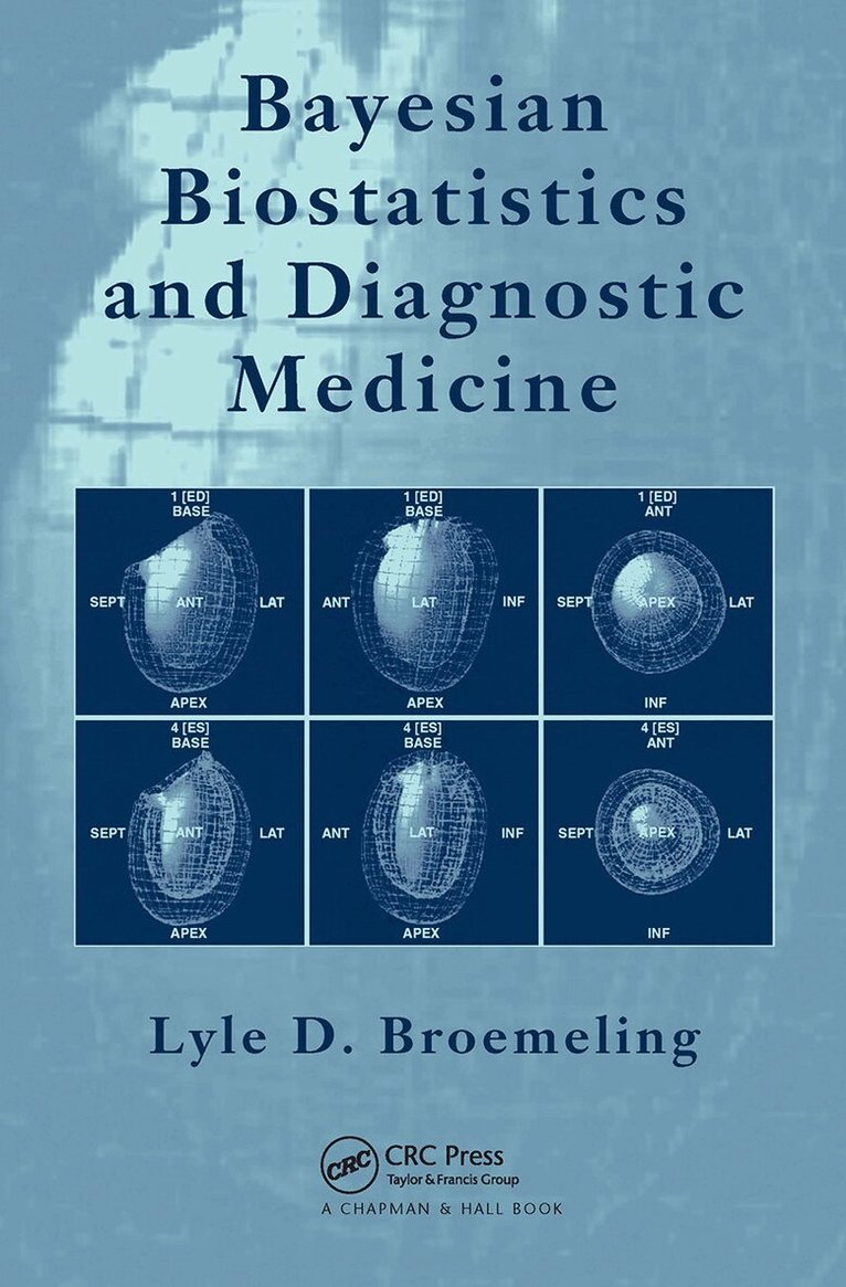 Lyle D. Broemeling - Bayesian Biostatistics and Diagnostic Medicine, Häftad. Tillgänglighet: Lägg i varukorg
