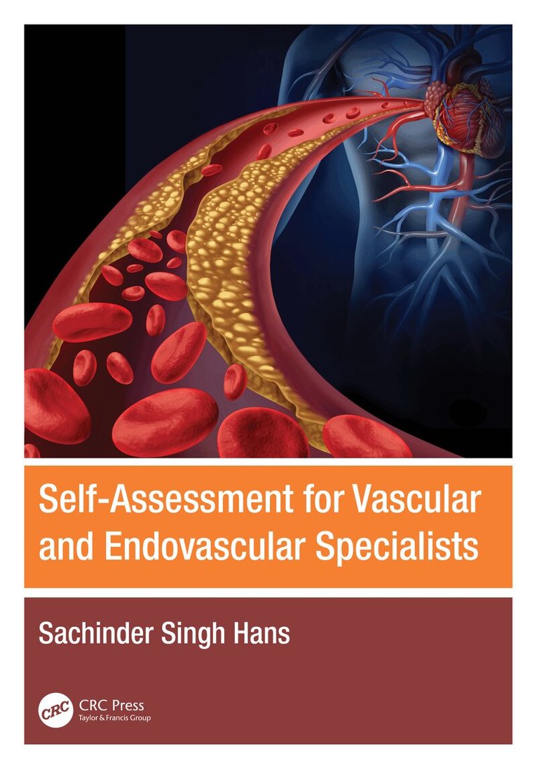 Sachinder Singh Hans - Self-Assessment for Vascular and Endovascular Specialists, Häftad. Tillgänglighet: Lägg i varukorg