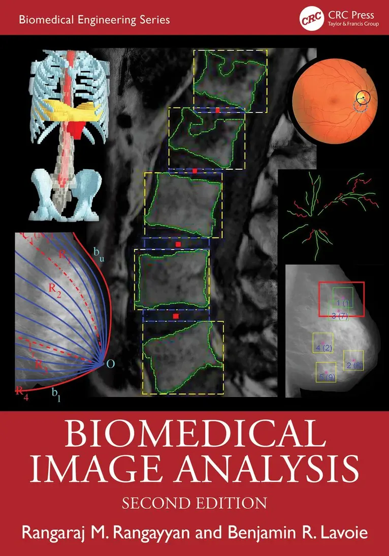 Rangaraj M. Rangayyan, Benjamin R. Lavoie - Biomedical Image Analysis, Inbunden. Tillgänglighet: Kommande