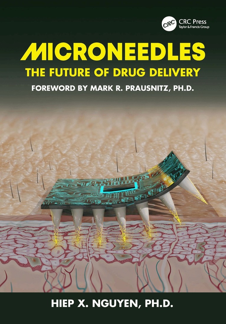 Hiep Xuan Nguyen - Microneedles, Häftad. Tillgänglighet: Lägg i varukorg
