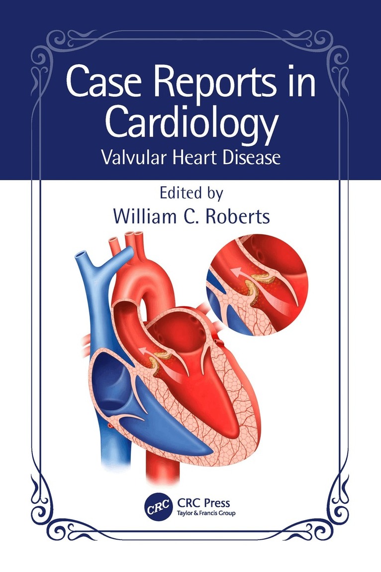 William C. Roberts - Case Reports in Cardiology, Häftad. Tillgänglighet: Lägg i varukorg