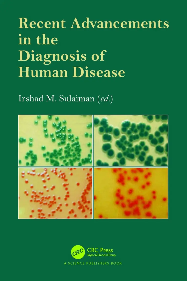 Irshad M. Sulaiman - Recent Advancements in the Diagnosis of Human Disease, Häftad. Tillgänglighet: Lägg i varukorg