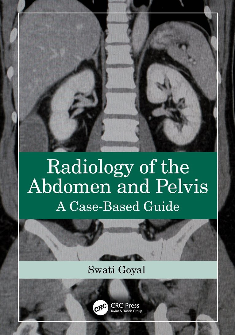 Swati Goyal - Radiology of the Abdomen and Pelvis, Häftad. Tillgänglighet: Lägg i varukorg