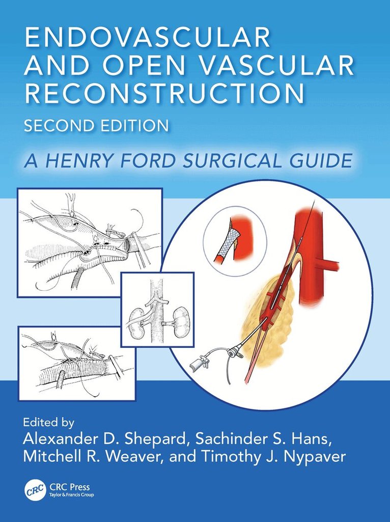 Alexander D. Shepard, Sachinder Singh Hans, Mitchell R. Weaver, Timothy J. Nypaver - Endovascular and Open Vascular Reconstruction, Inbunden