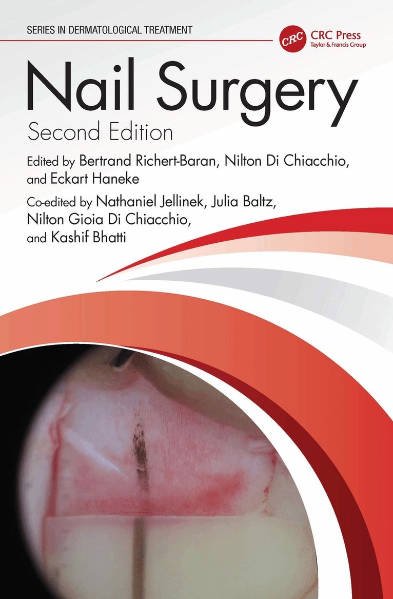 Bertrand Richert, Nilton Di Chiacchio, Eckart Haneke, Nathaniel Jellinek, Julia Baltz, Nilton Gioia Di Chiacchio, Kashif Bhatti - Nail Surgery, Inbunden