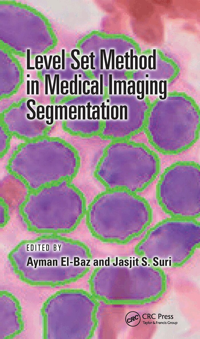 Ayman El-Baz, Jasjit S. Suri - Level Set Method in Medical Imaging Segmentation, Häftad