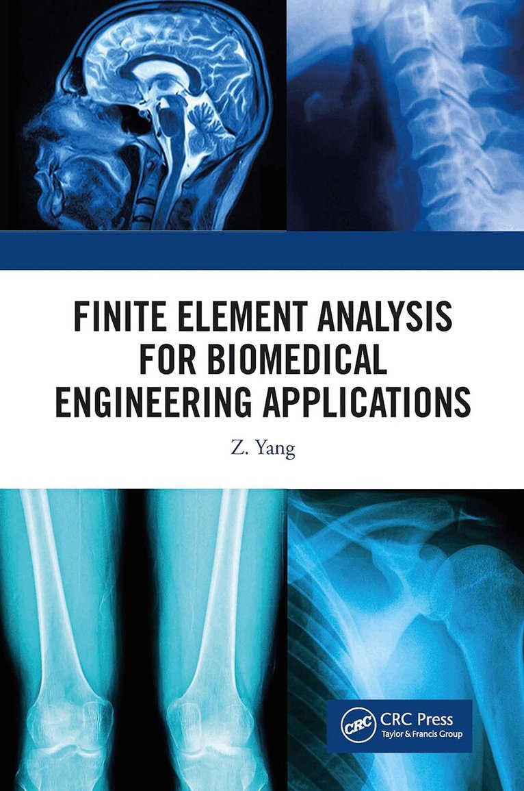 Z. Yang - Finite Element Analysis for Biomedical Engineering Applications, Häftad. Tillgänglighet: Lägg i varukorg
