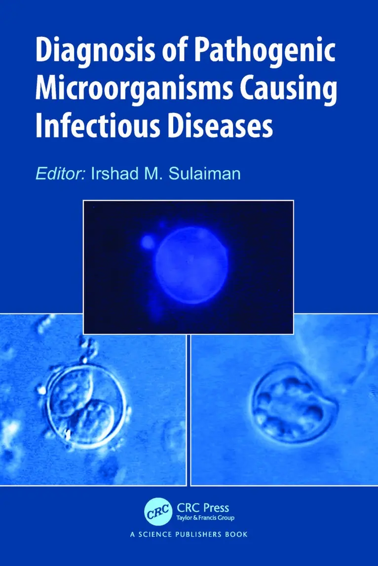 Irshad M. Sulaiman - Diagnosis of Pathogenic Microorganisms Causing Infectious Diseases, Häftad. Tillgänglighet: Lägg i varukorg