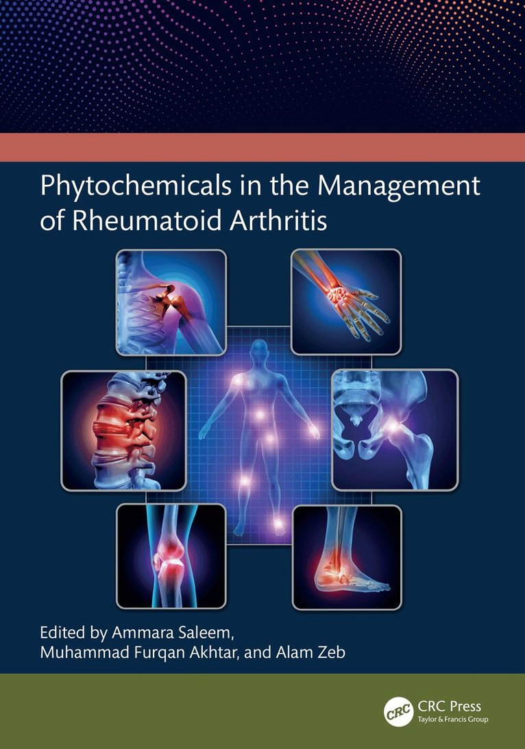 Ammara Saleem, Muhammad Furqan Akhtar, Alam Zeb - Phytochemicals in the Management of Rheumatoid Arthritis, Inbunden