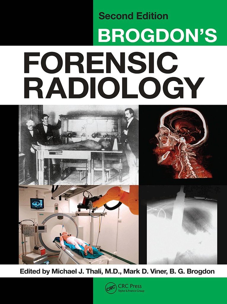 Michael J. Thali, Mark D. Viner, B. G. Brogdon - Brogdon's Forensic Radiology, Häftad. Tillgänglighet: Lägg i varukorg