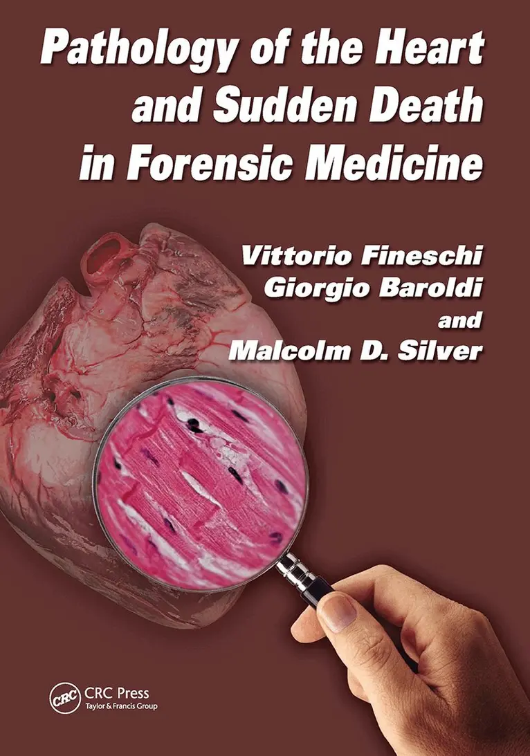 Vittorio Fineschi, Giorgio Baroldi, Malcolm D. Silver - Pathology of the Heart and Sudden Death in Forensic Medicine, Häftad. Tillgänglighet: Lägg i varukorg