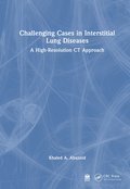 Challenging Cases in Interstitial Lung Diseases