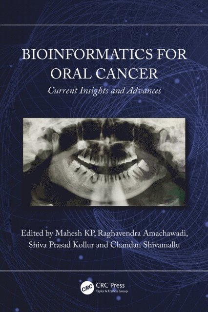 Chandan Shivamallu, Shiva Prasad Kollur, Raghavendra Amachawadi, Mahesh KP - Bioinformatics for Oral Cancer, E-bok