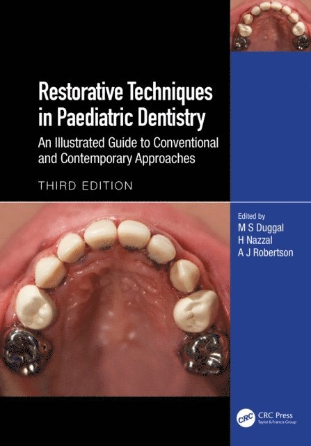 A J Robertson, H Nazzal, M S Duggal - Restorative Techniques in Paediatric Dentistry, E-bok