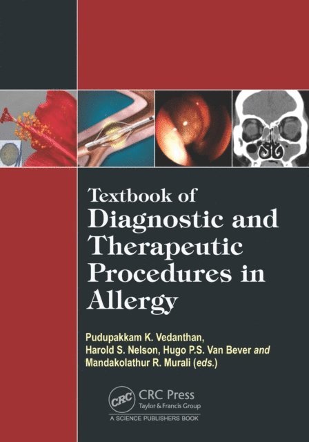 Mandakolathur R Murali, Hugo Van Bever, Harold S. Nelson, Pudupakkam K. Vedanthan - Textbook of Diagnostic and Therapeutic Procedures in Allergy, E-bok