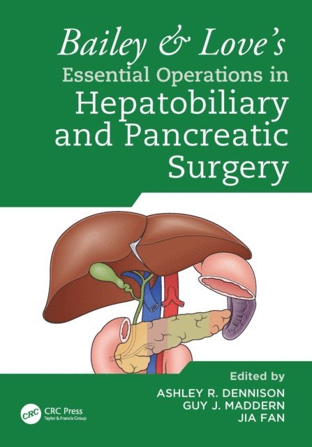 Jia Fan, Guy Maddern, Ashley Dennison - Bailey & Love's Essential Operations in Hepatobiliary and Pancreatic Surgery, E-bok