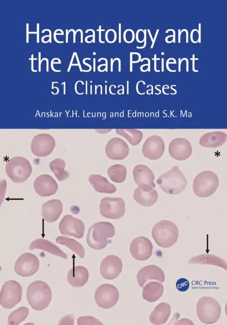 Edmond S K Ma, Anskar Y.H. Leung - Haematology and the Asian Patient, E-bok. Tillgänglighet: Lägg i varukorg