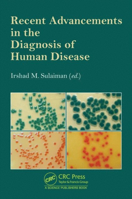 Irshad M. Sulaiman - Recent Advancements in the Diagnosis of Human Disease, E-bok. Tillgänglighet: Lägg i varukorg
