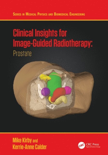 Kerrie-Anne Calder, Mike Kirby - Clinical Insights for Image-Guided Radiotherapy, E-bok