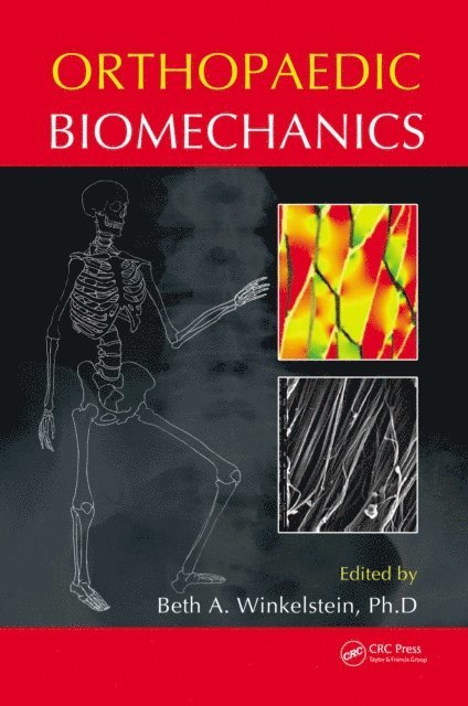 Beth A. Winkelstein - Orthopaedic Biomechanics, E-bok