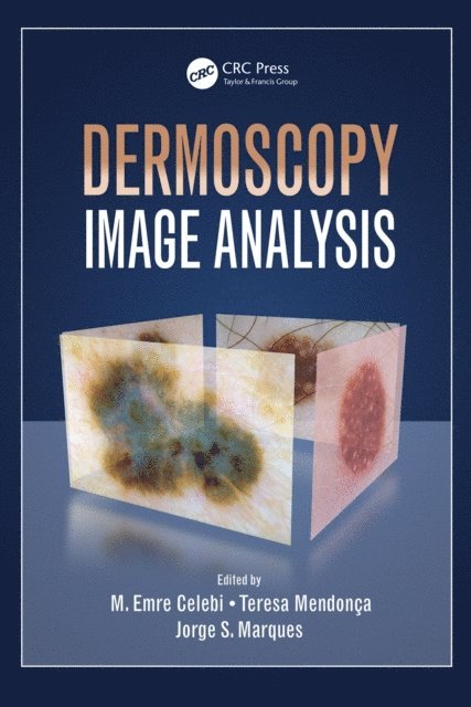 Jorge S. Marques, Teresa Mendonca, M. Emre Celebi - Dermoscopy Image Analysis, E-bok