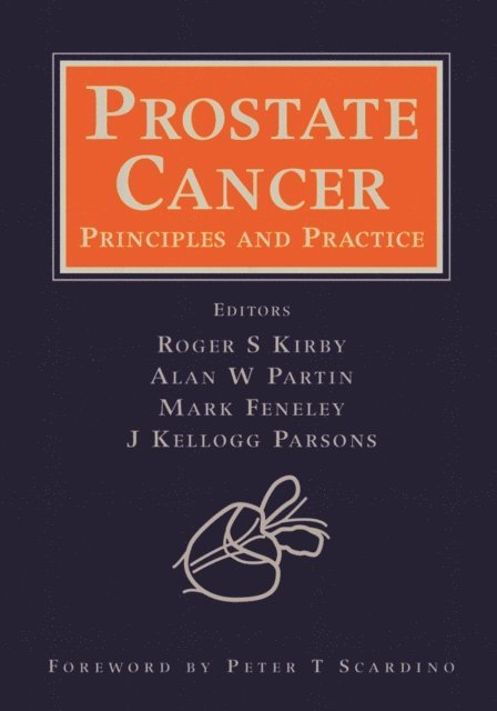 J. Kellogg Parsons, Mark Feneley, Alan W. Partin, Roger S. Kirby - Prostate Cancer, E-bok