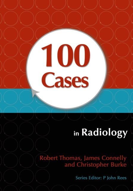 Christopher Burke, James Connelly, Robert Thomas - 100 Cases in Radiology, E-bok