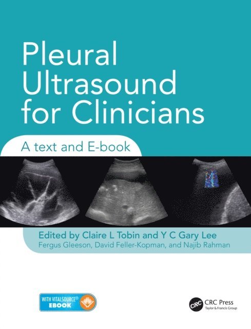 David Feller-Kopman, Najib Rahman, Fergus Gleeson, Y C Gary Lee, Claire Tobin - Pleural Ultrasound for Clinicians, E-bok