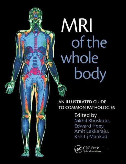 Kshitij Mankad, Amit Lakkaraju, Edward Hoey, Nikhil Bhuskute - MRI of the Whole Body, E-bok