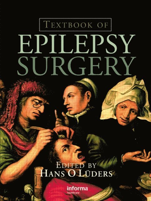 Hans O. Luders - Textbook of Epilepsy Surgery, E-bok