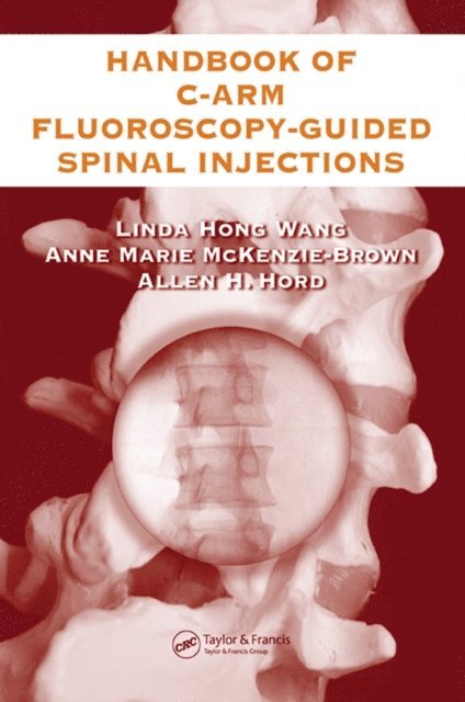 Allen Hord, Anne Marie McKenzie-Brown, Linda Hong Wang - Handbook of C-Arm Fluoroscopy-Guided Spinal Injections, E-bok