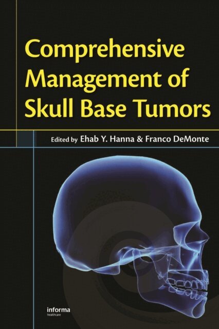 Franco DeMonte, Ehab Y. Hanna - Comprehensive Management of Skull Base Tumors, E-bok