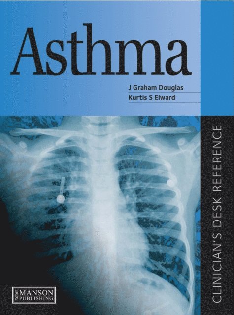Kurtis Elward, J Douglas - Asthma, E-bok