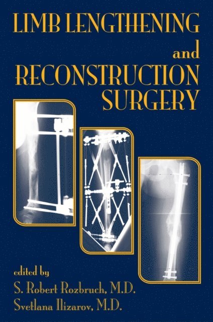 Svetlana Ilizarov, S. Robert Rozbruch - Limb Lengthening and Reconstruction Surgery, E-bok