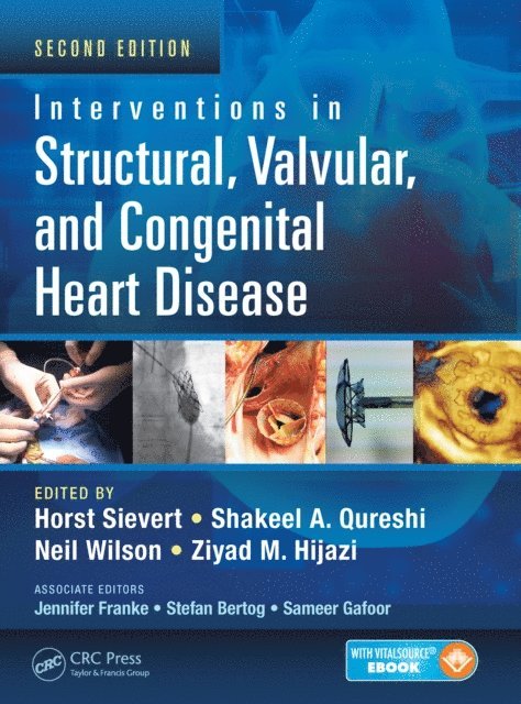 Ziyad M. Hijazi, Neil Wilson, Shakeel A. Qureshi, Horst Sievert - Interventions in Structural, Valvular and Congenital Heart Disease, E-bok