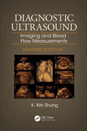 K. Kirk Shung - Diagnostic Ultrasound, E-bok
