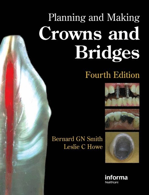 Leslie C. Howe, Bernard G. N. Smith - Planning and Making Crowns and Bridges, E-bok